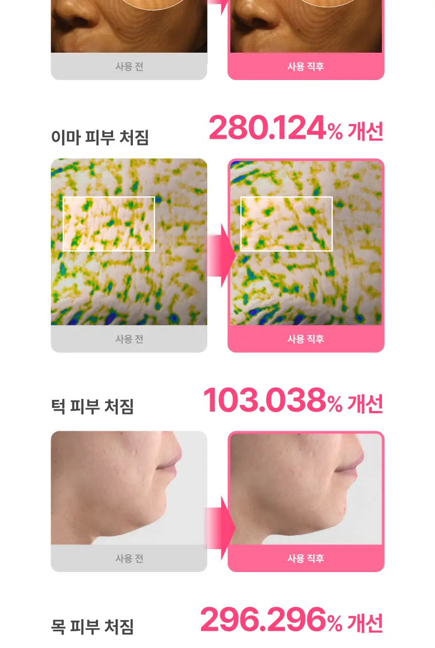 [홈케어/5분순삭,탄력흡수 더블케어] 듀얼소닉 하이이피 더블샷 (+비건콜라겐젤 정품 증정) 상세페이지 26